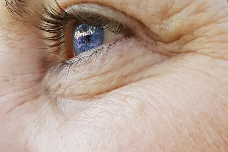 An extreme close up of a woman with wrinkles wondering how to get rid of wrinkles
